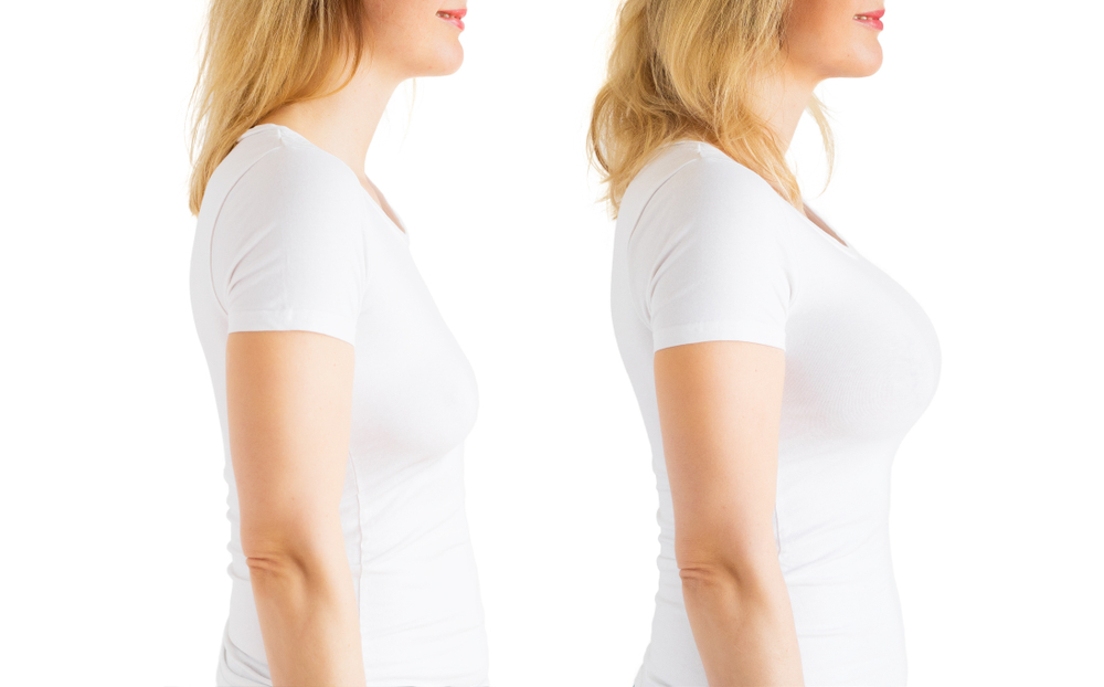 How to Fix Uneven Breasts for Long-Lasting Results