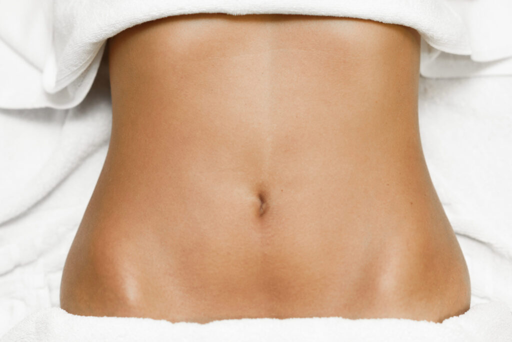 Failed Tummy Tuck? Key Signs to Watch